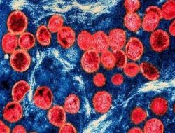 WHO Khawatir, Sebaran Penyakit Monkeypox di Republik Kongo Terus Melonjak