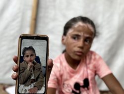 Vitiligo dan Sejumlah Penyakit Aneh Serang Anak-anak Gaza di Tengah Genosida Israel